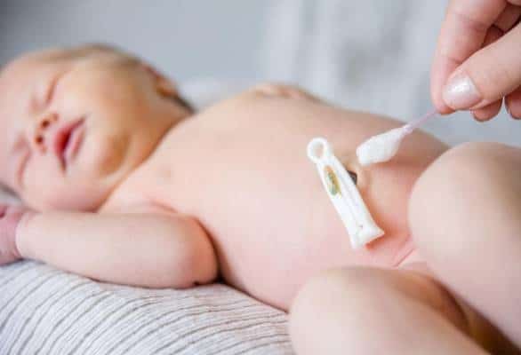 عفونت بند ناف در نوزادان
