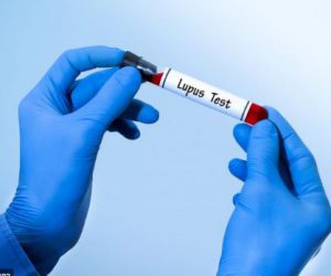 مشکل خونی در بیماری لوپوس