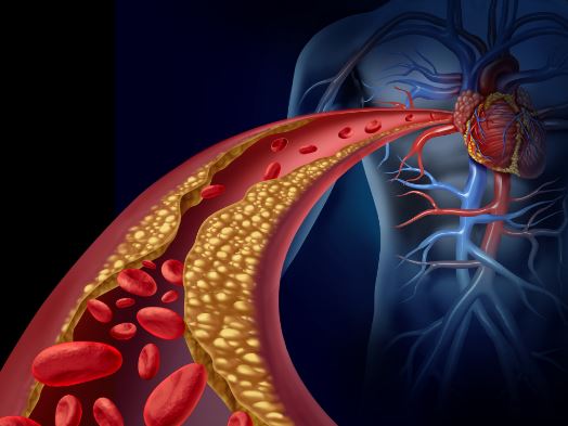 12 عامل افزایش دهنده خطر حمله قلبی که نباید نادیده گرفته شود