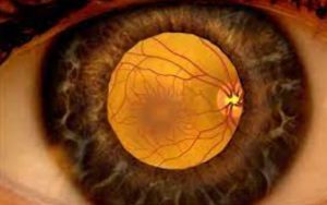 علایم بیماری های چشمی