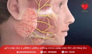 سرطان غدد بزاقی