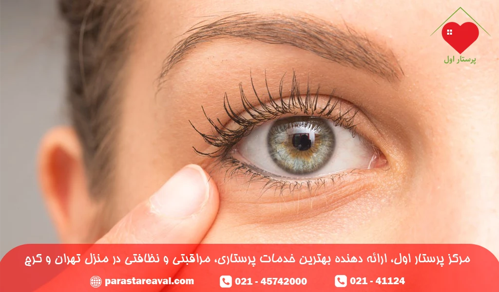 گل مژه چشم