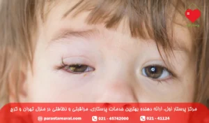 عفونت چشم نوزاد