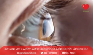 چشم آستیگمات