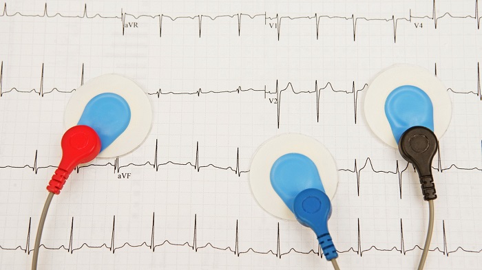 نوار قلب بیمار دچار نقص عضو چگونه انجام می شود؟