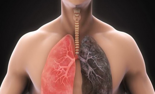 بیماری های تنفسی