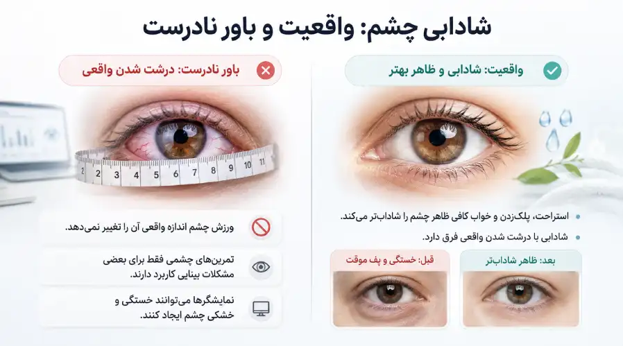 درشت شدن چشم
