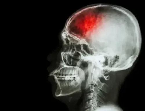 مراقبت از بیمار سکته مغزی چگونه است؟