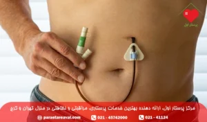 پگ معده چیست؛ مراقبت و عوارض peg معده