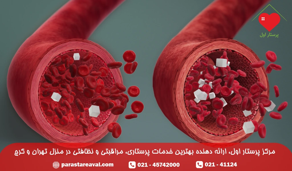 علائم و نشانههای کمبود پتاسیم خون
