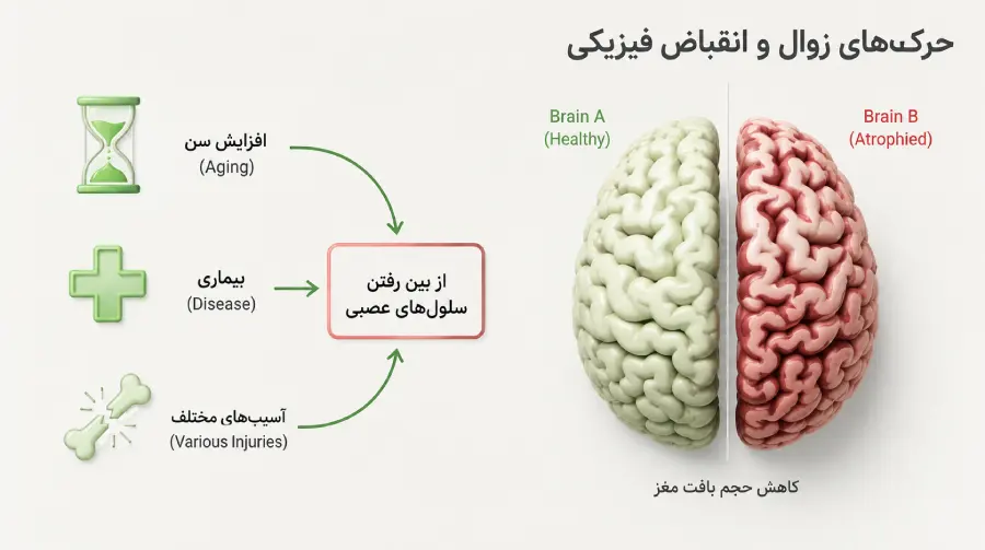 کوچک شدن مغز سالمندان و مرگ